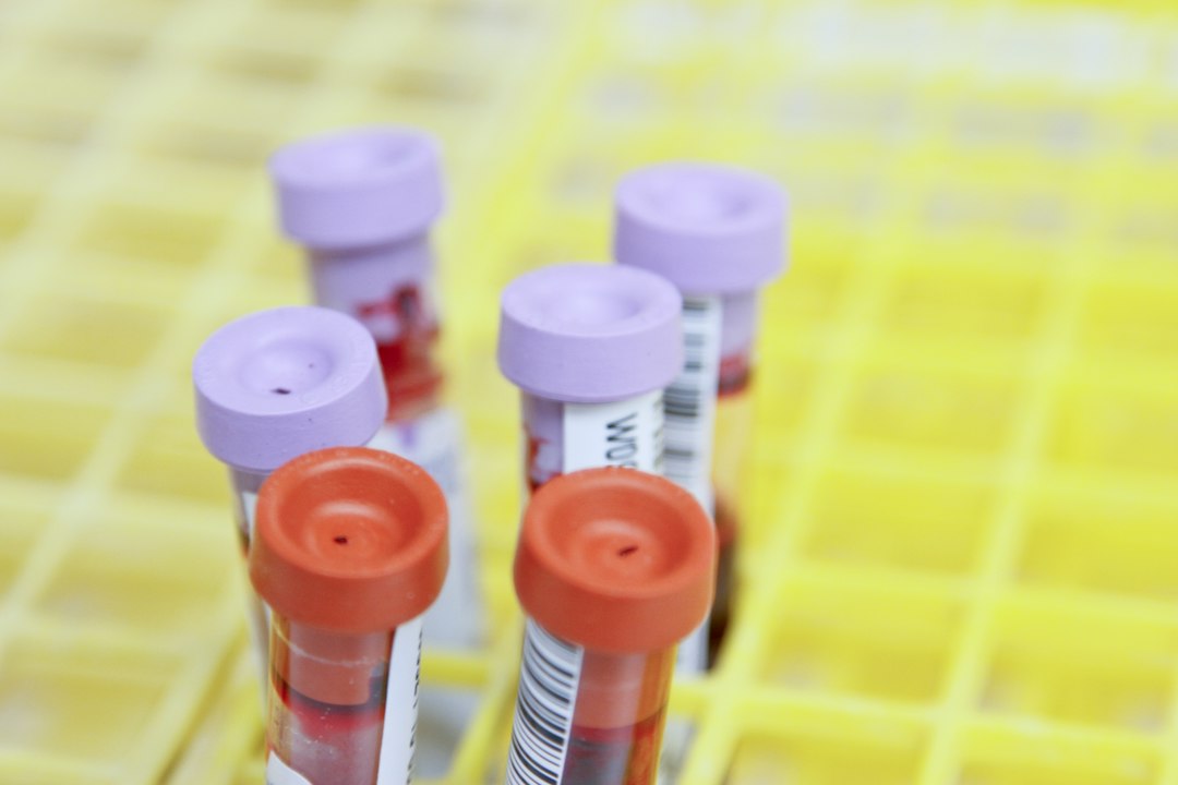 Laboratory blood samples in test tubes, illustrating clinical laboratory testing